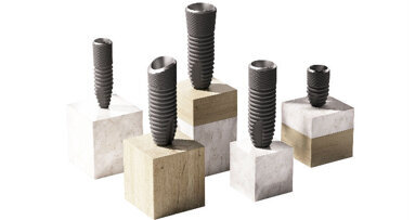 Innovazione, soluzioni digitali e versatilità, l'evoluzione di Astra Tech Implant System continua