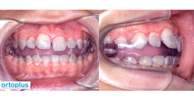 Fabrican el primer Teuscher 100% digital