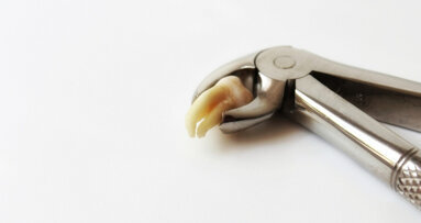 Het KIMO stelt nieuwe richtlijn ‘Derde Molaar’ beschikbaar