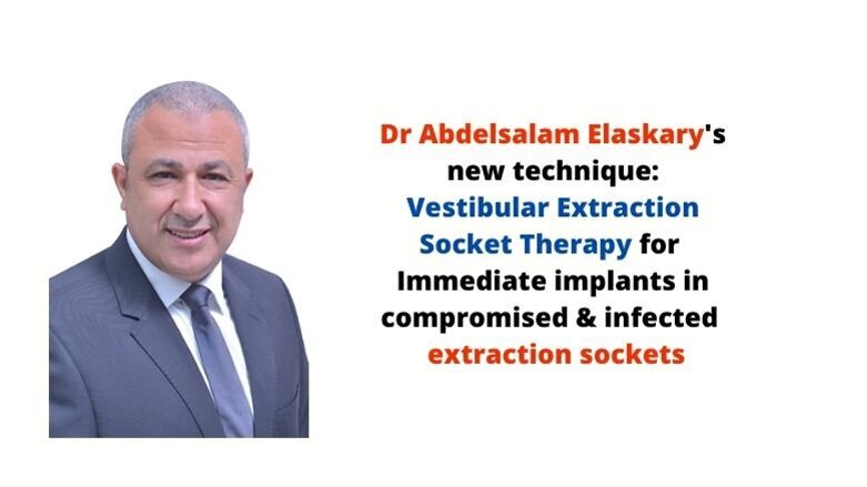 Elaskary's Vestibular Extraction Socket Therapy: Immediate implants in compromised infected sockets
