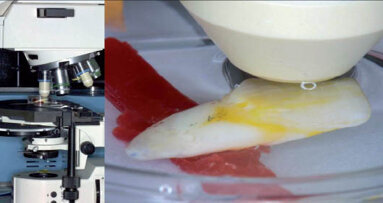 Struktura povrchu skloviny po bělení pohledem konfokálního mikroskopu