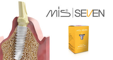 Implanty MIS SEVEN – nowa jakość i udoskonalenia, poparte badaniami