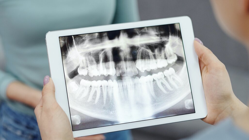 Kemik İyileşme Sürecini Hızlandıran Buluş