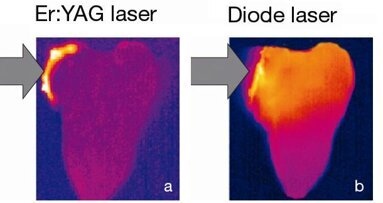 TouchWhite―Next-generation tooth whitening