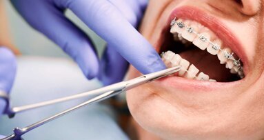 Startschuss für die Facharztausbildung für Kieferorthopädie