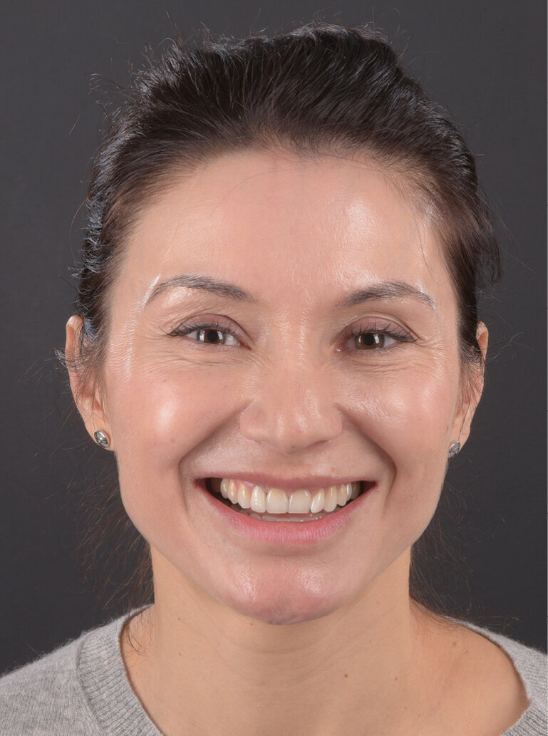 Fig. 1. Portrait image prior to the intervention