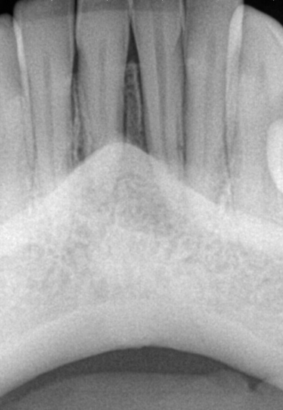 Fig. 1: Pre-op radiograph of the patient.