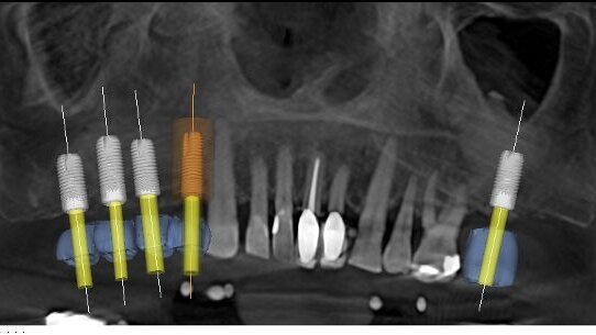 “Once you’ve tried it, you can’t drink anything else”