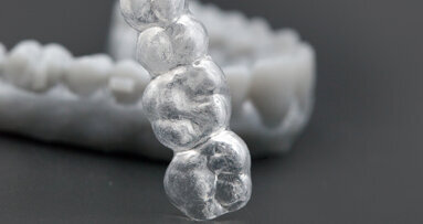 „Díky 4D tisku budeme schopni nabídnout mnohem dokonalejší léčbu“