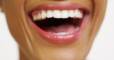 Oberstes Ziel: Verbesserung der Mundgesundheit