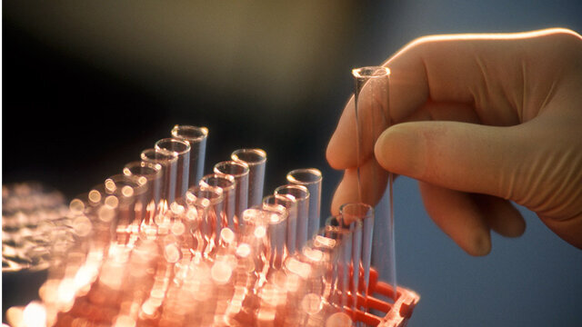 Profit-driven practices affecting quality of pharmaceutical products: Experts