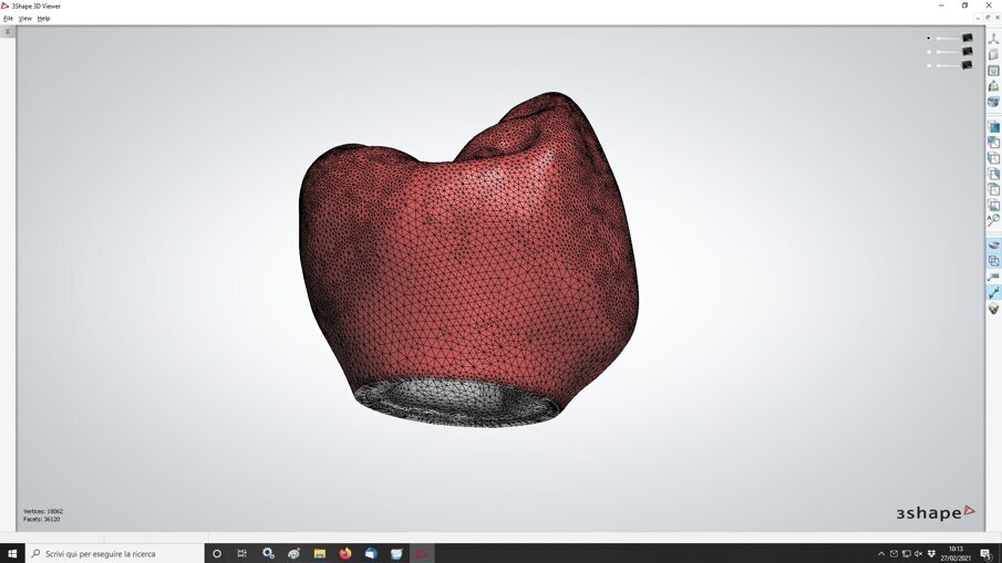 Fig. 14_Visione dell’algoritmo che costruirà la corona definitiva nella visione morfologica esterna laterale.