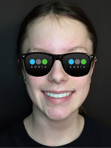 Fig. 16: Patient’s facial photograph after aligner treatment.