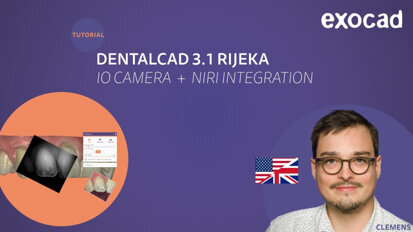 exocad – IO Camera and NIRI Integration