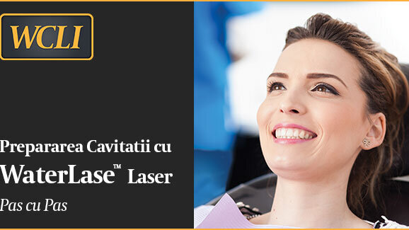 Prepararea cavitatii cu laser pas cu pas