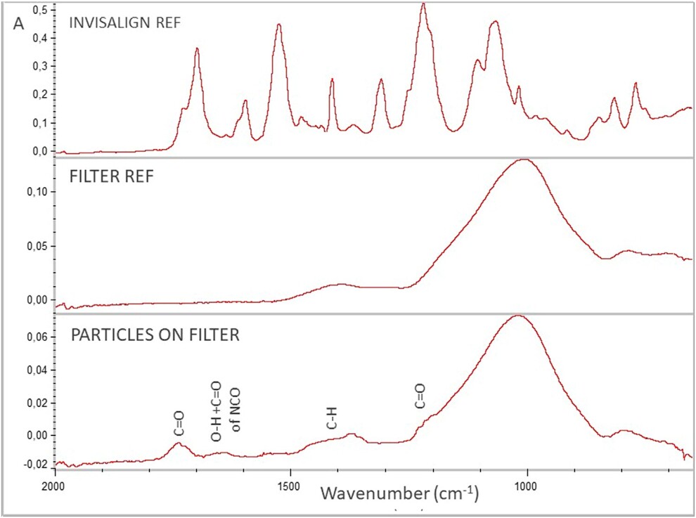 Fig. 2: The particulate debris released from Invisalign aligners shared the chemical signature of the aligner polymer: micro-attenuated total reflection spectra of the fibreglass filter after immersion and filtration of Invisalign aligners displayed characteristic peaks identical to those of the Invisalign reference material, confirming that the particles attached to the filter surface originated from the aligner. For comparison, spectra of the Invisalign reference, the clean fiberglass filter and the post-filtration particles are shown across the 2,000–650 cm–¹ wavenumber range (absorbance scale; image: Dr Nearchos Panayi et al.).