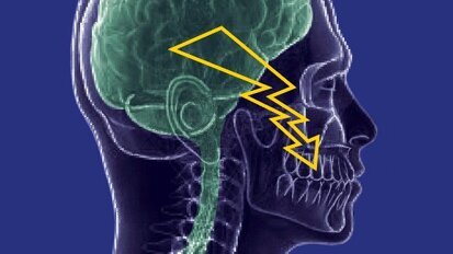 Pesquisadores a desenvolvem tratamento para dor do nervo que afetam os dentes e o rosto