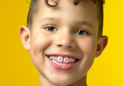 Align Technology – Invisalign Stickables