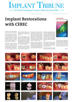 Implant Tribune Middle East & Africa No. 2, 2018