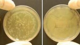 Prozone potwierdza skuteczność ozonu w leczeniu stomatologicznym