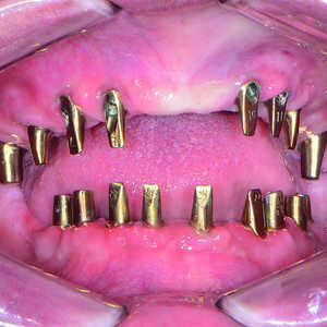 Fig-19-Piliers-Inclusive-fabriqués-par-CFAO-300x300-