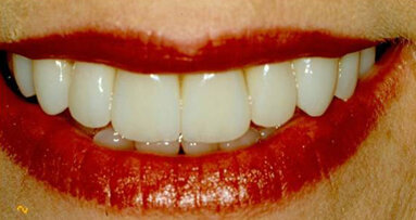 Getting acquainted with Insta-Ortho