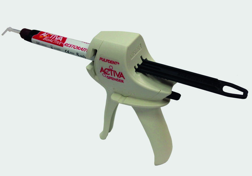 Fig. 5 : ACTIVA BioACTIVE-RESTORATIVE est un matériau de restauration bioactif qui induit une reminéralisation. 