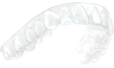 SureSmile® Aligner