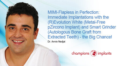 Extraction and implantation in just one session: Expert explains how