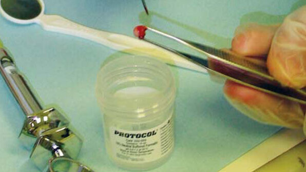 Klucz do wczesnej diagnostyki chorób nowotworowych