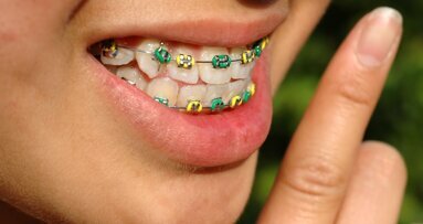 Invloed van beugelbehandeling op weefsel onderzocht