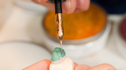 日本种植手术治疗失败率高