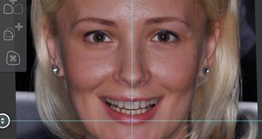 Technologia z Brazylii stworzy symetryczne uśmiechy