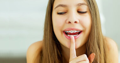 Relationship between early orthodontic treatment and OH-related quality of life confirmed