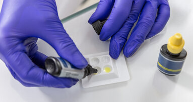 Uporedjena sposobnost prodiranja u dentin materijala za punjenje kanala i metode obturacije Uporedjena sposobnost prodiranja u dentin materijala za punjenje kanala i metode obturacije