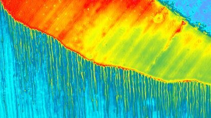 DT Study Club: Webinar behandelt dentale Adhäsivtechnik DT Study Club: Webinar behandelt dentale Adhäsivtechnik