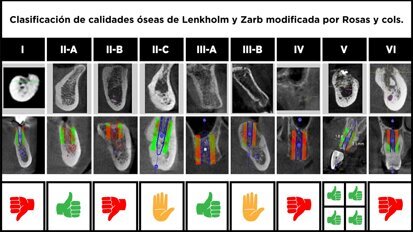 Tecnologías de última generación para el manejo periodontal y perimplantar en paciente adulto mayor