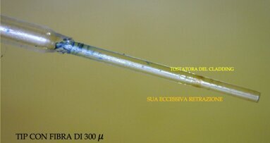 Attivazione della fibra del Laser a Diodo