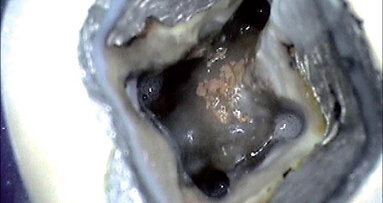 Když se příroda vysmívá endodontistům – dvě kazuistiky