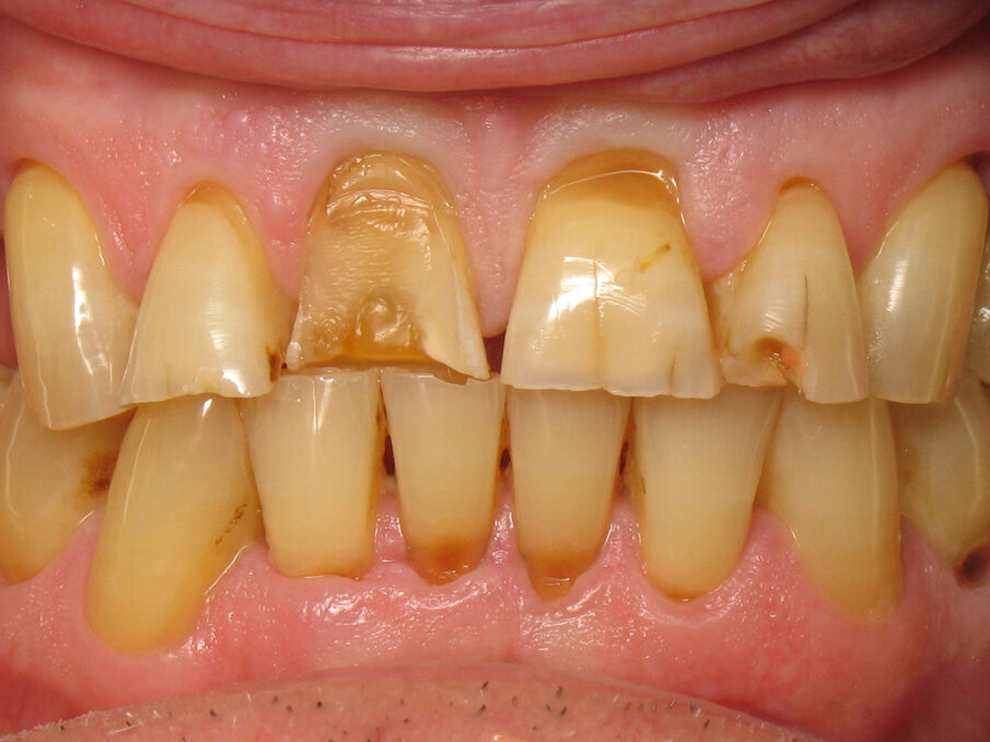 Fig. 11: Initial situation.