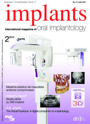 implants Italy No. 2, 2014 implants Italy No. 2, 2014