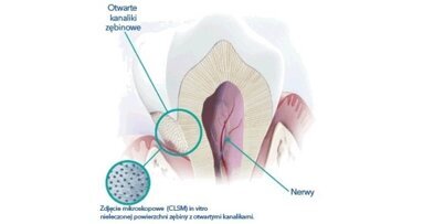 Profesjonalne sposoby na nadwrażliwość zębów