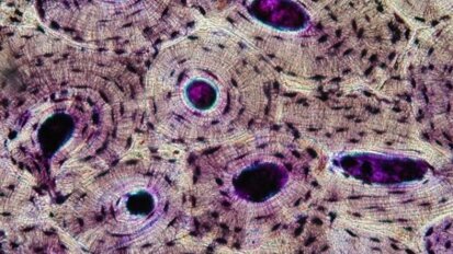 Unikatowy projekt hodowli komórek ludzkich kości