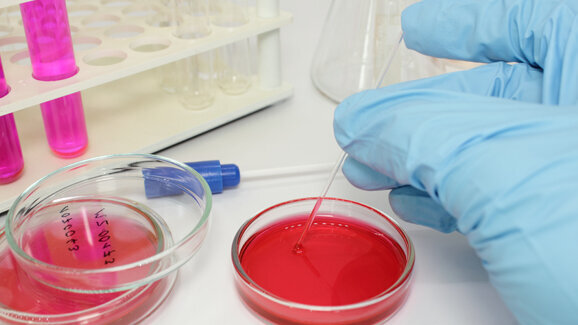 Forscher finden Ursache für Biofilm-Entstehung