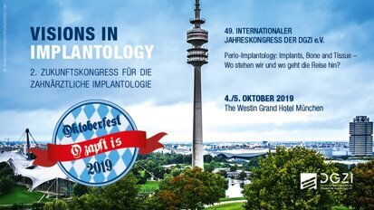 2. Zukunftskongress der DGZI mit Live-OPs & Table Clinics 2. Zukunftskongress der DGZI mit Live-OPs & Table Clinics