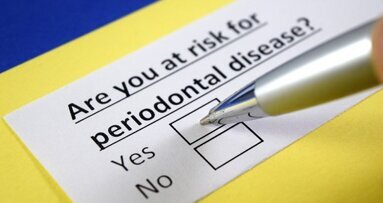 Ricercatori identificano sezioni del DNA responsabili della parodontite