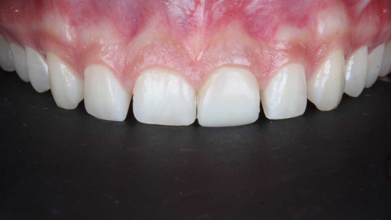 Adding intra-oral photographs to patient files significantly enhances documentation. (Image: Mahfuz Rahman)