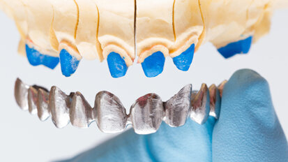 Umfrage für Zahnärzte gestartet: Wohin geht die digitale Reise? Umfrage für Zahnärzte gestartet: Wohin geht die digitale Reise?