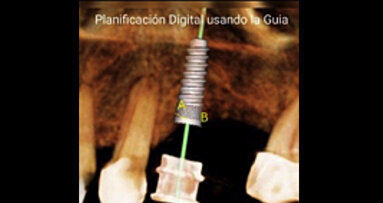 El odontólogo debe detectar precozmente las enfermedades de sus pacientes