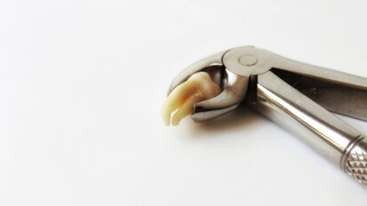 Het KIMO stelt nieuwe richtlijn ‘Derde Molaar’ beschikbaar